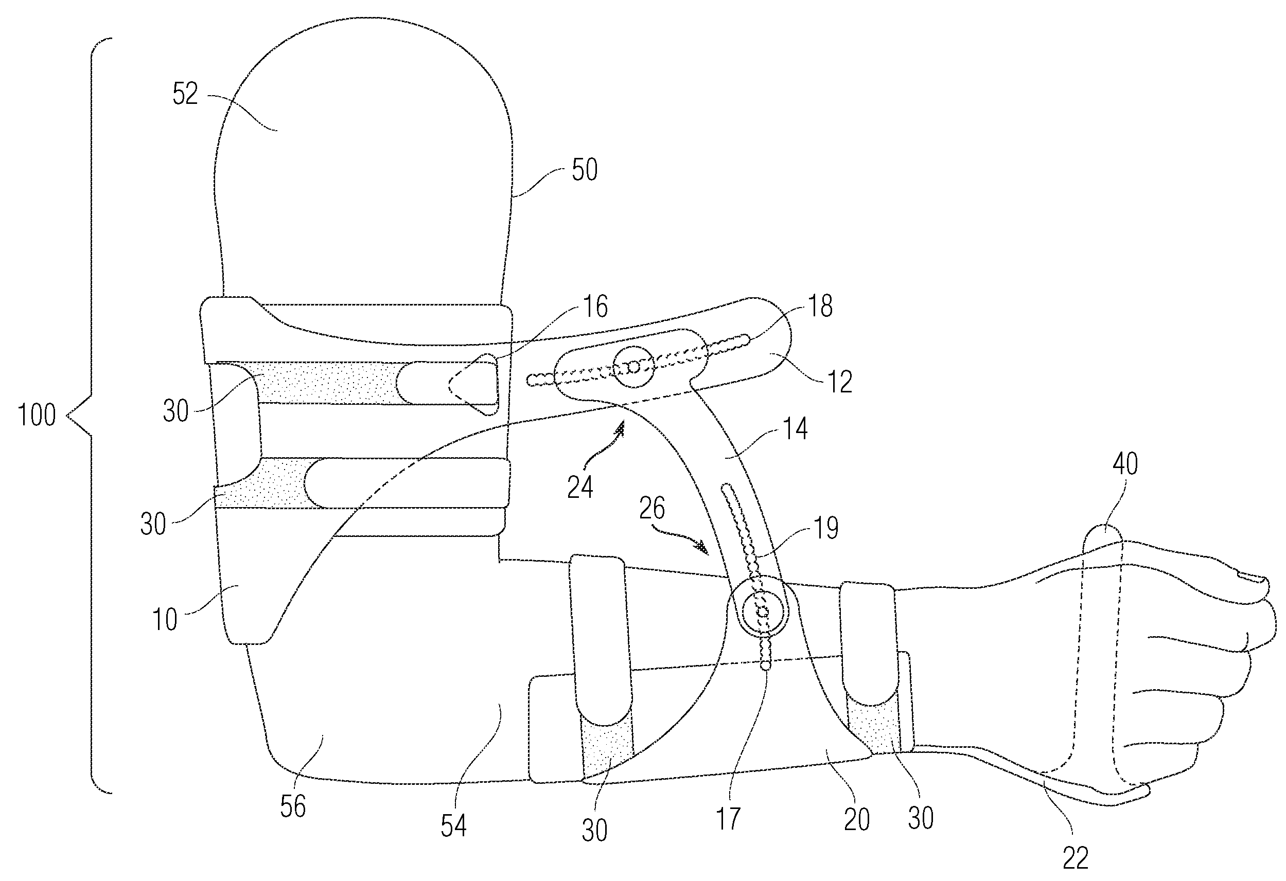 Extremity support apparatus and method