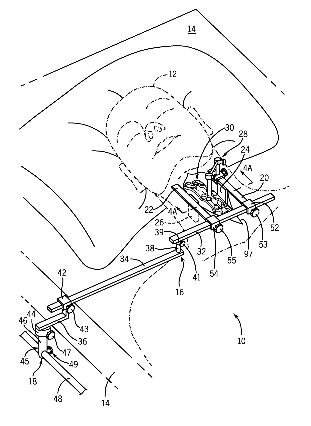 Anterior cervical retractor system