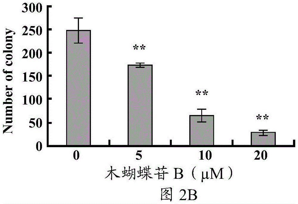 Application of oroxin B and drug containing oroxin B