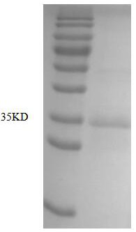 Subunit vaccine against feline infectious peritonitis virus and application