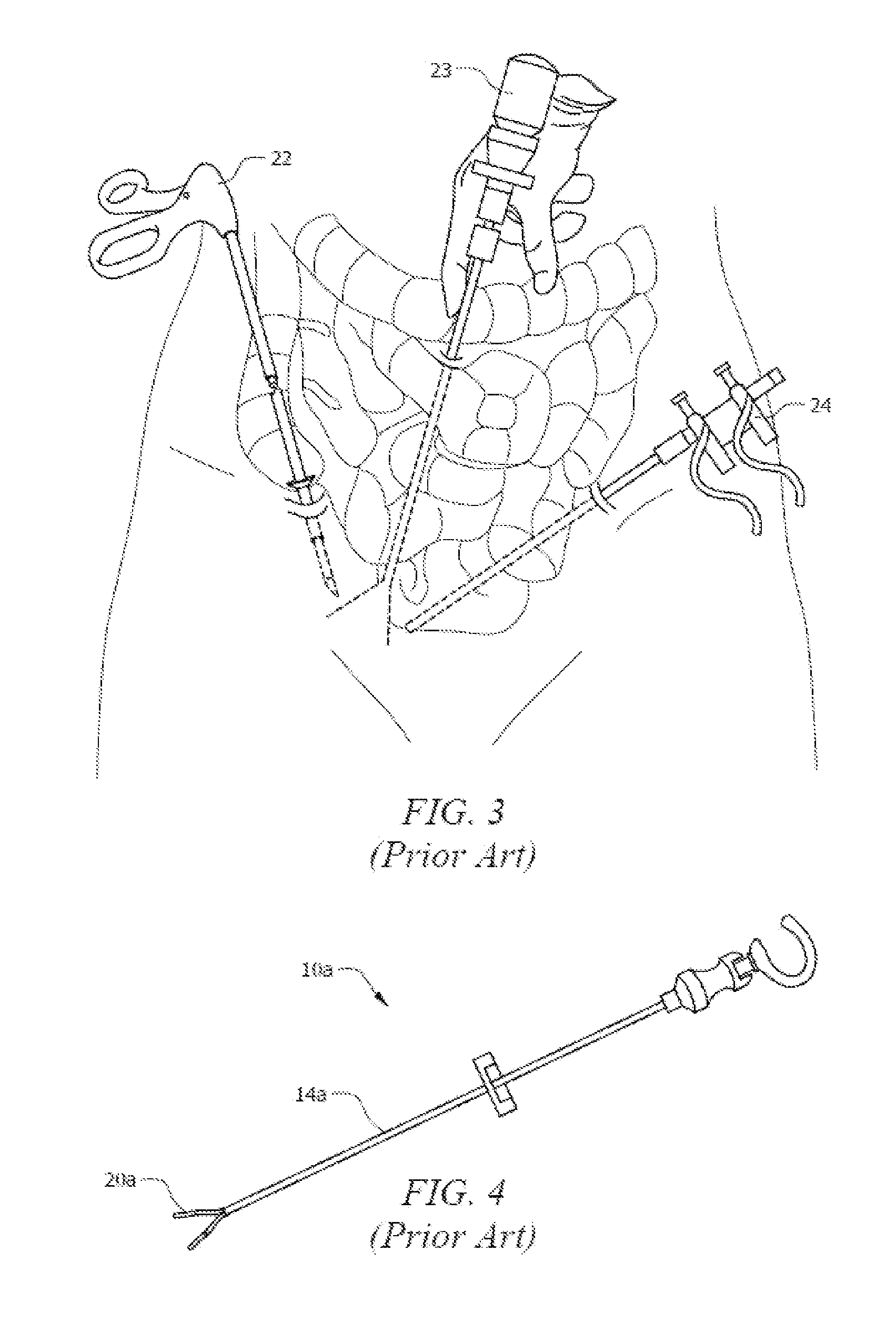 Small diameter laparoscopic tool having releasable tip