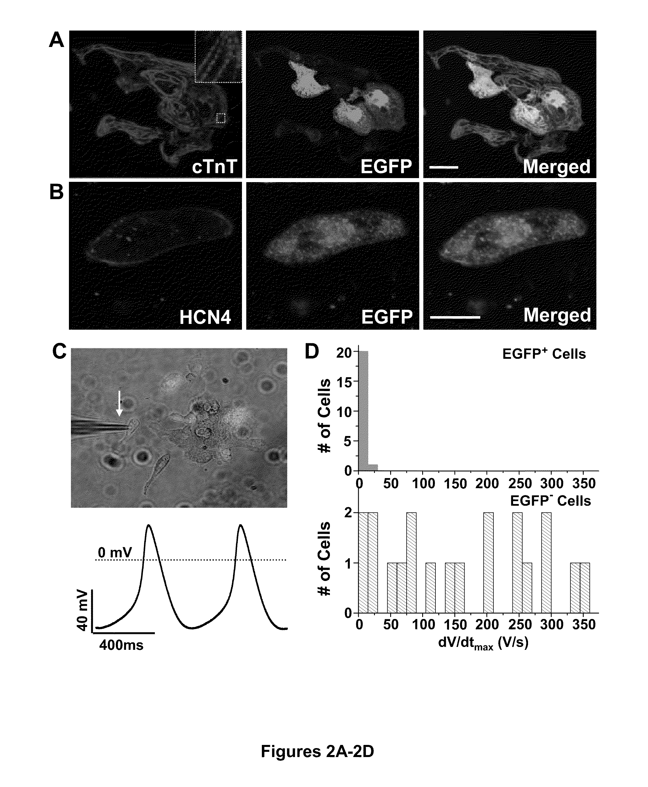 Induction of human embryonic stem cell derived cardiac pacemaker or chamber-type cardiomyocytes by manipulation of neuregulin signaling