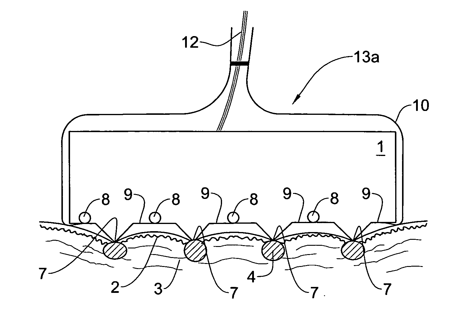 Method and system for invasive skin treatment