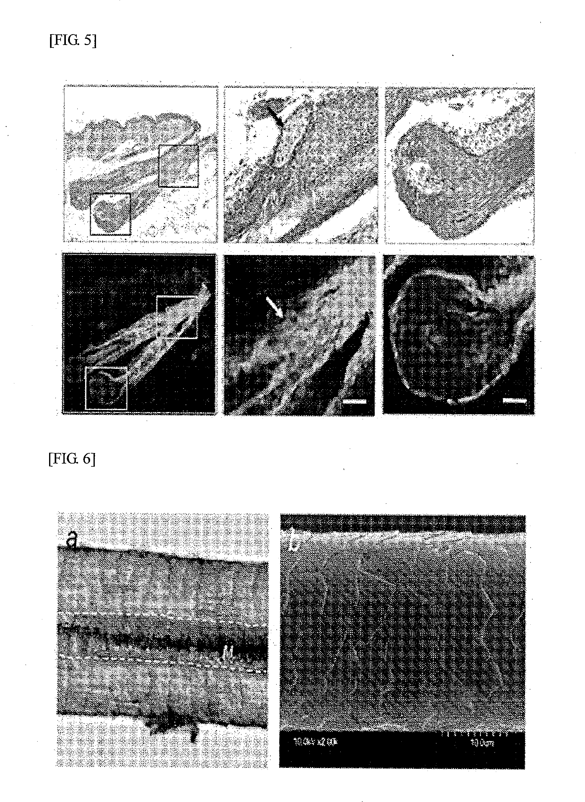 Method for producing regenerative organ primordium provided with guide for transplantation, composition containing regenerative organ primordium provided with guide for transplantation produced thereby, and method for trnsplanting regenerative organ primordium provided with guide for transplantation