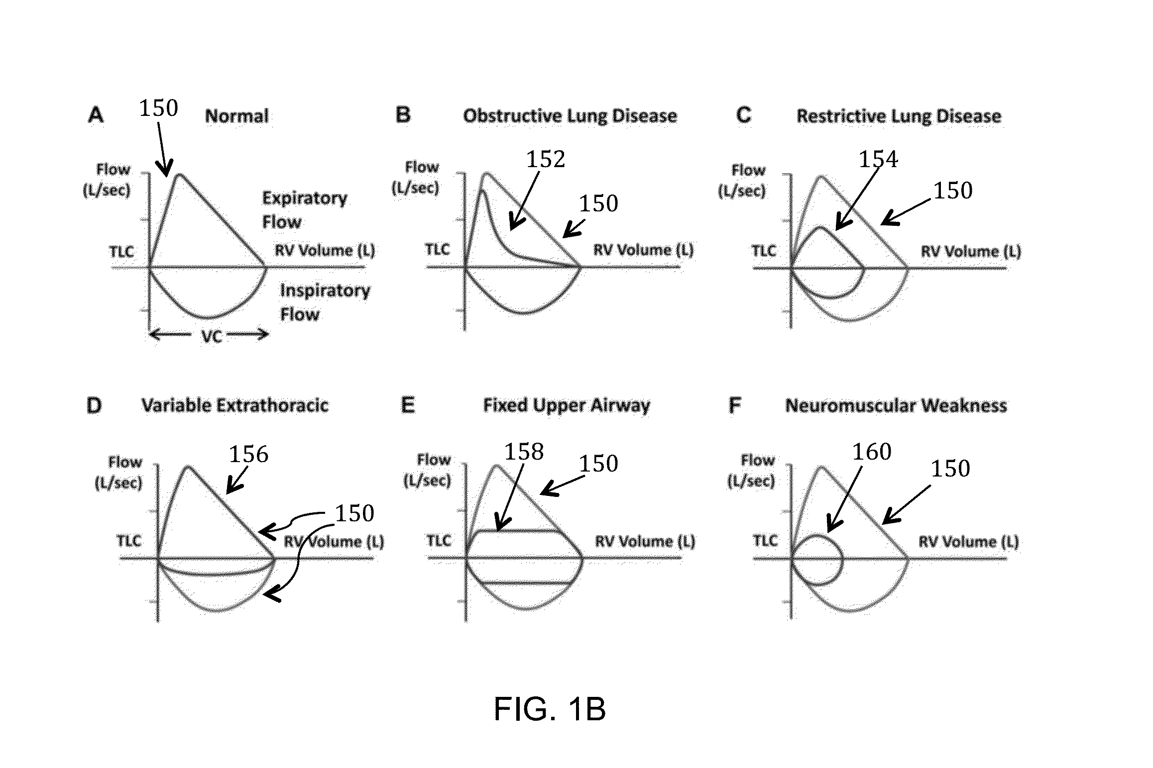 System and method for respiratory system assessment