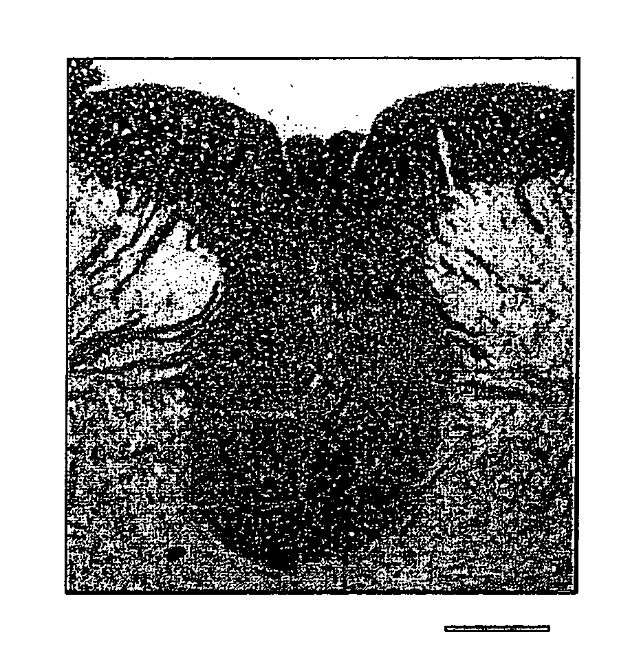 Cell fractions containing cells capable of differentiating into neural cells