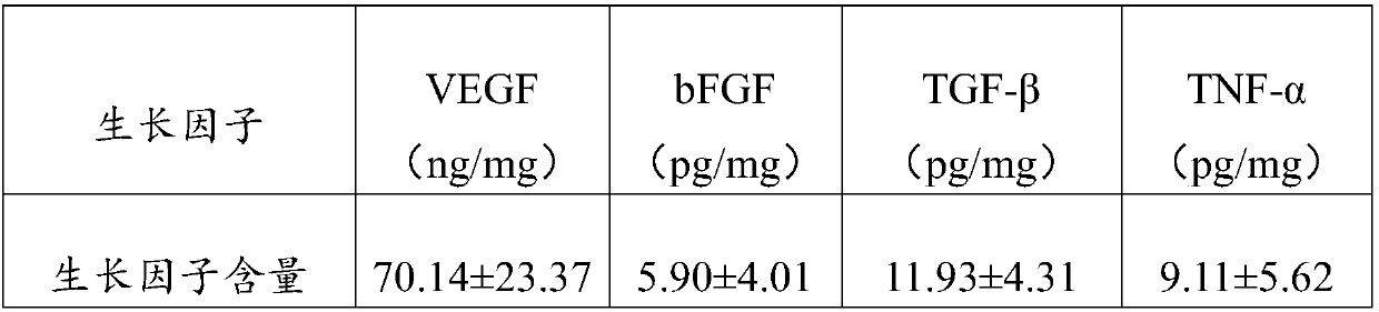 Injectable decellularized small intestinal submucosal matrix particles and preparation method and application thereof