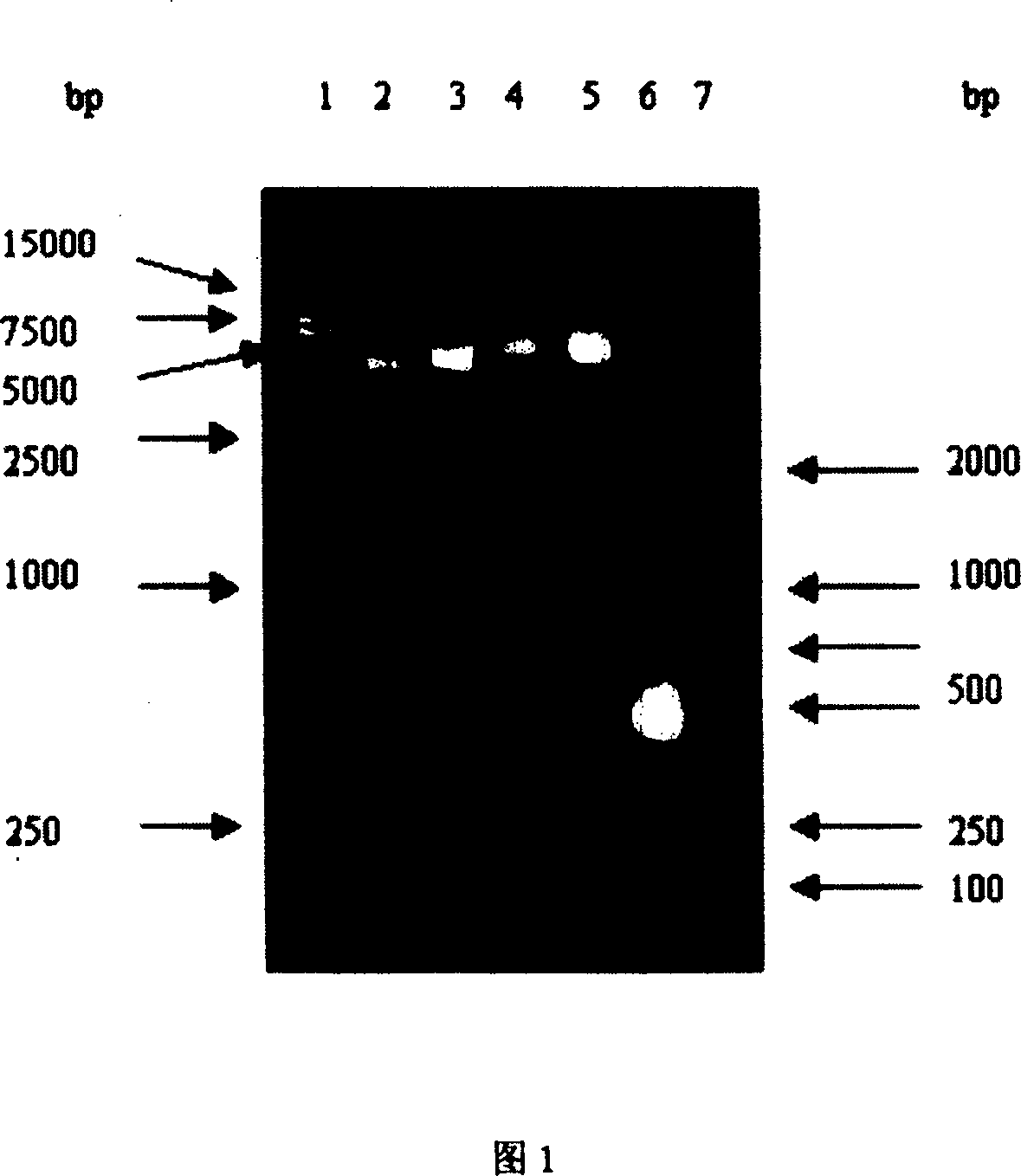 Interfusion protein of antineoplastic genetic engineering composed of target short peptide of receptor of epidermal growth factor and Lidamycin