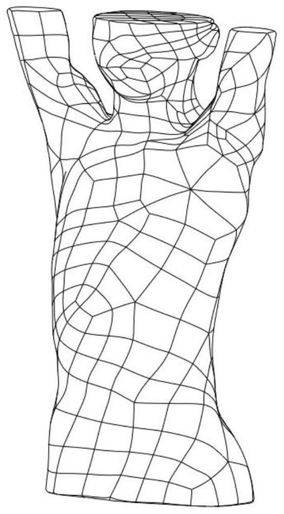 A design method of personalized 3D printed scoliosis orthosis