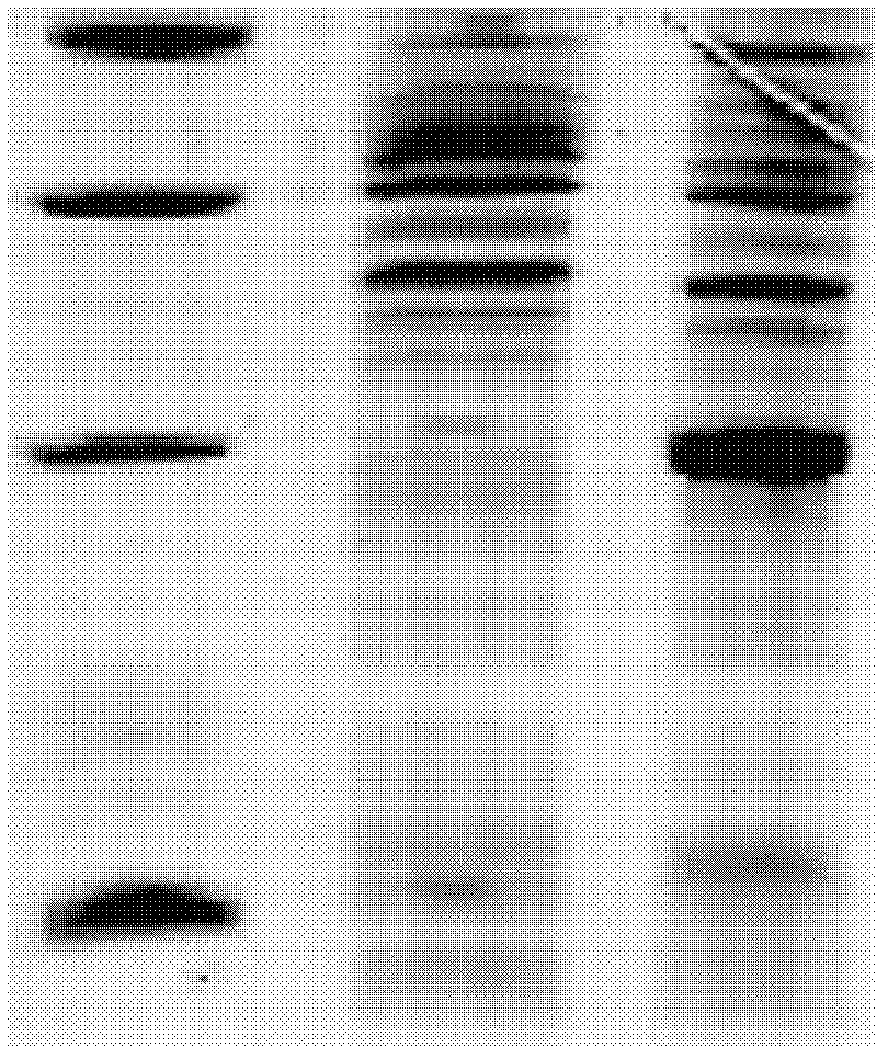 Enterovirus 71 capsid protein 3 recombinant antigen and application thereof