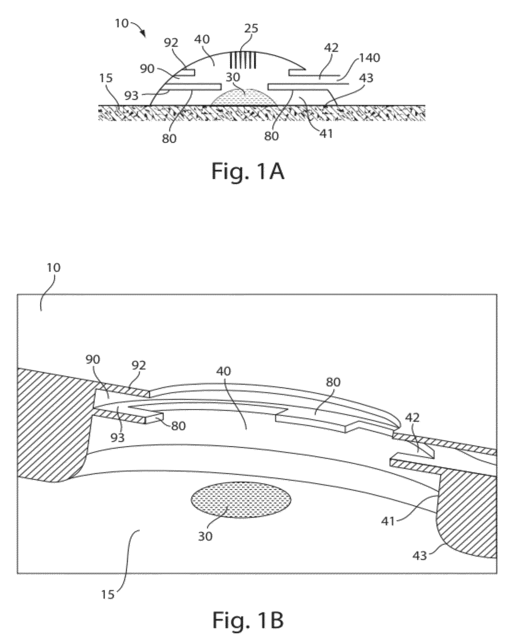 Systems and methods for collecting fluid from a subject