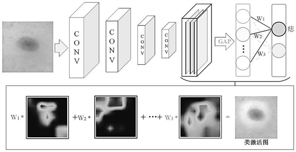 Medical image classification method and classification device thereof