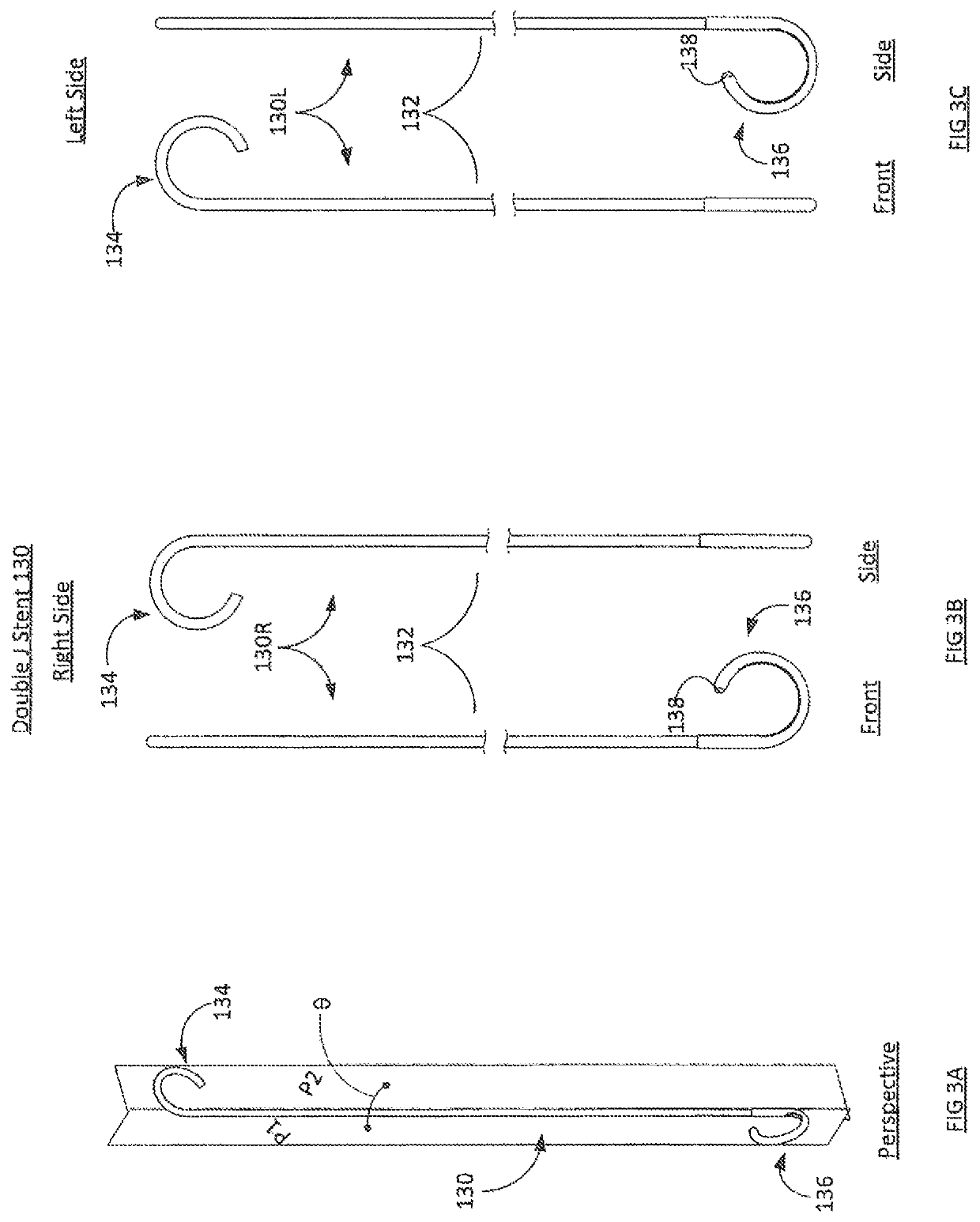 Stent and method of use