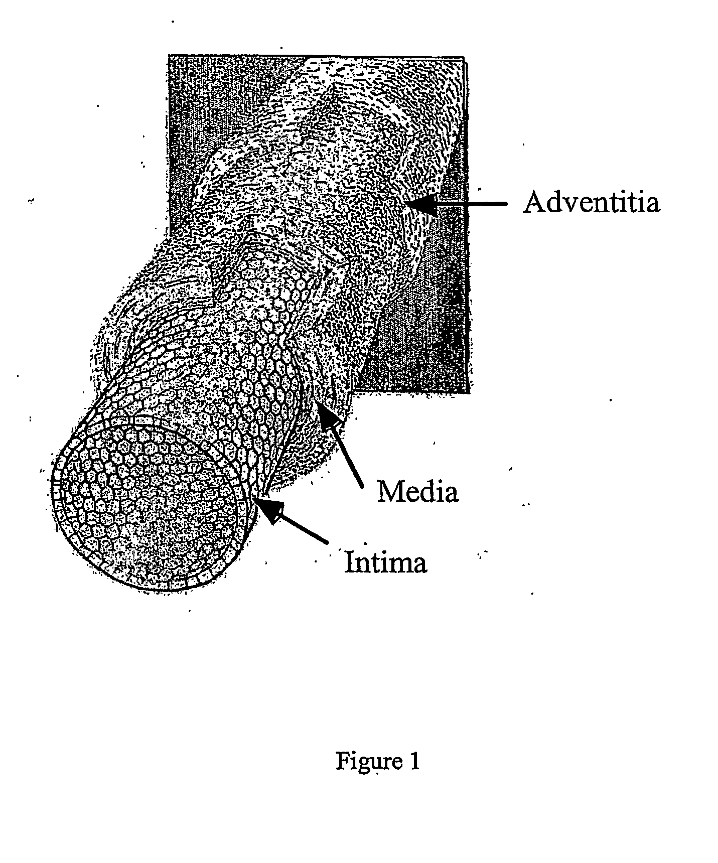 Engineered blood vessels