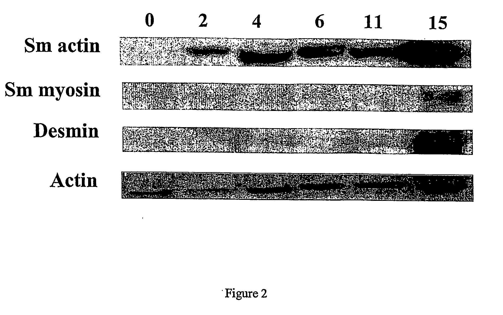 Engineered blood vessels