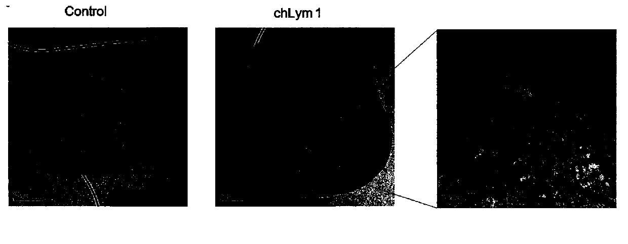 Pharmaceutical composition treating tumors