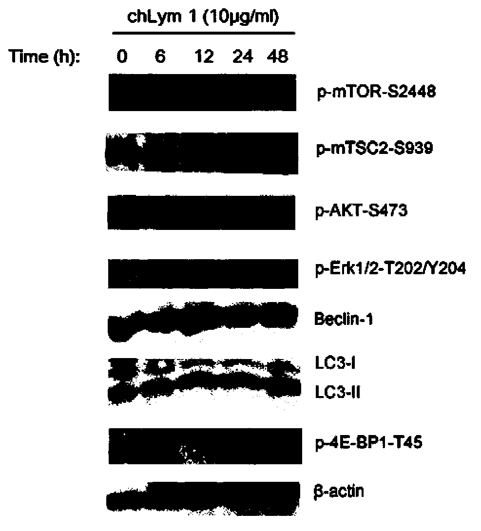 Pharmaceutical composition treating tumors