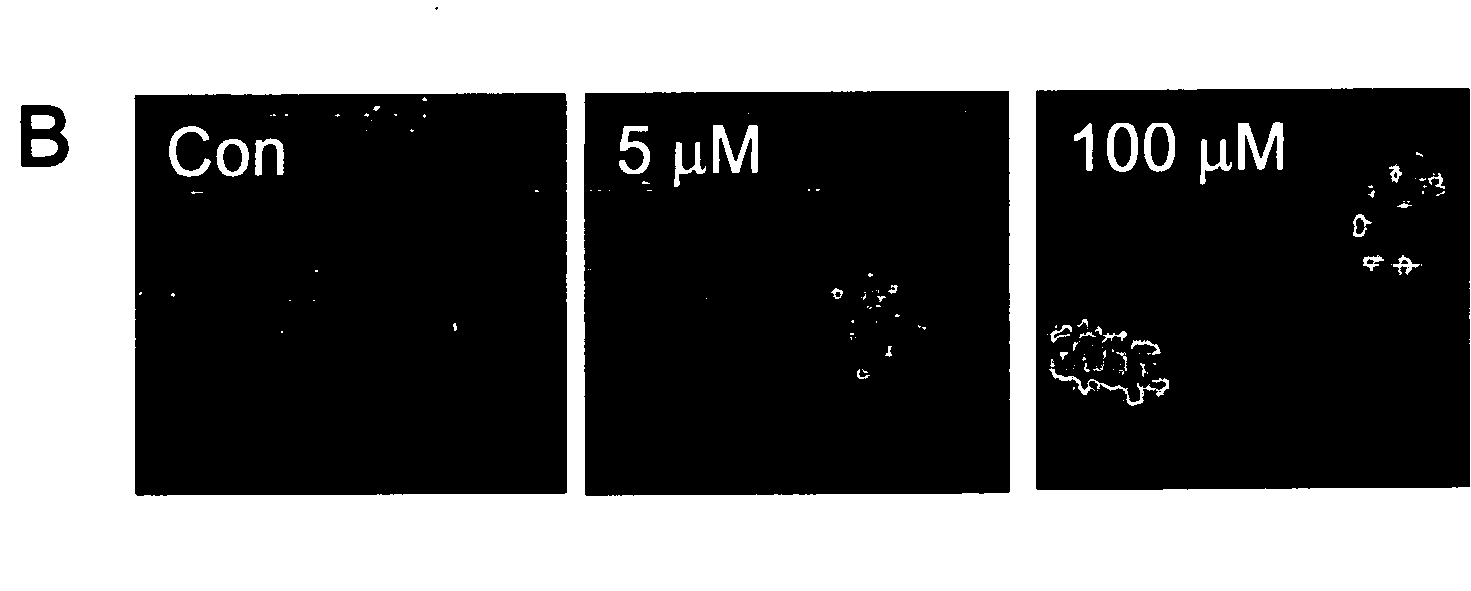 Methods of neuroprotection by cyclin-dependent kinase inhibition