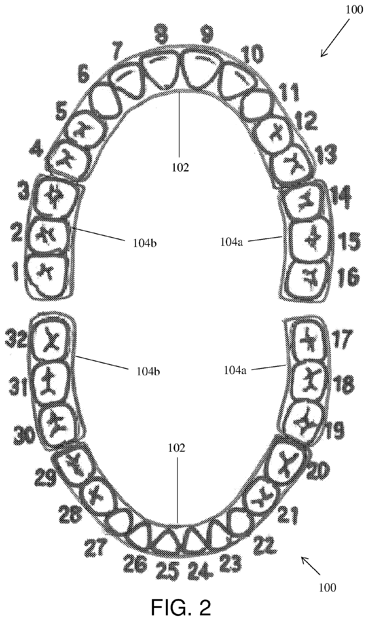 Full arch dental treatment devices and systems