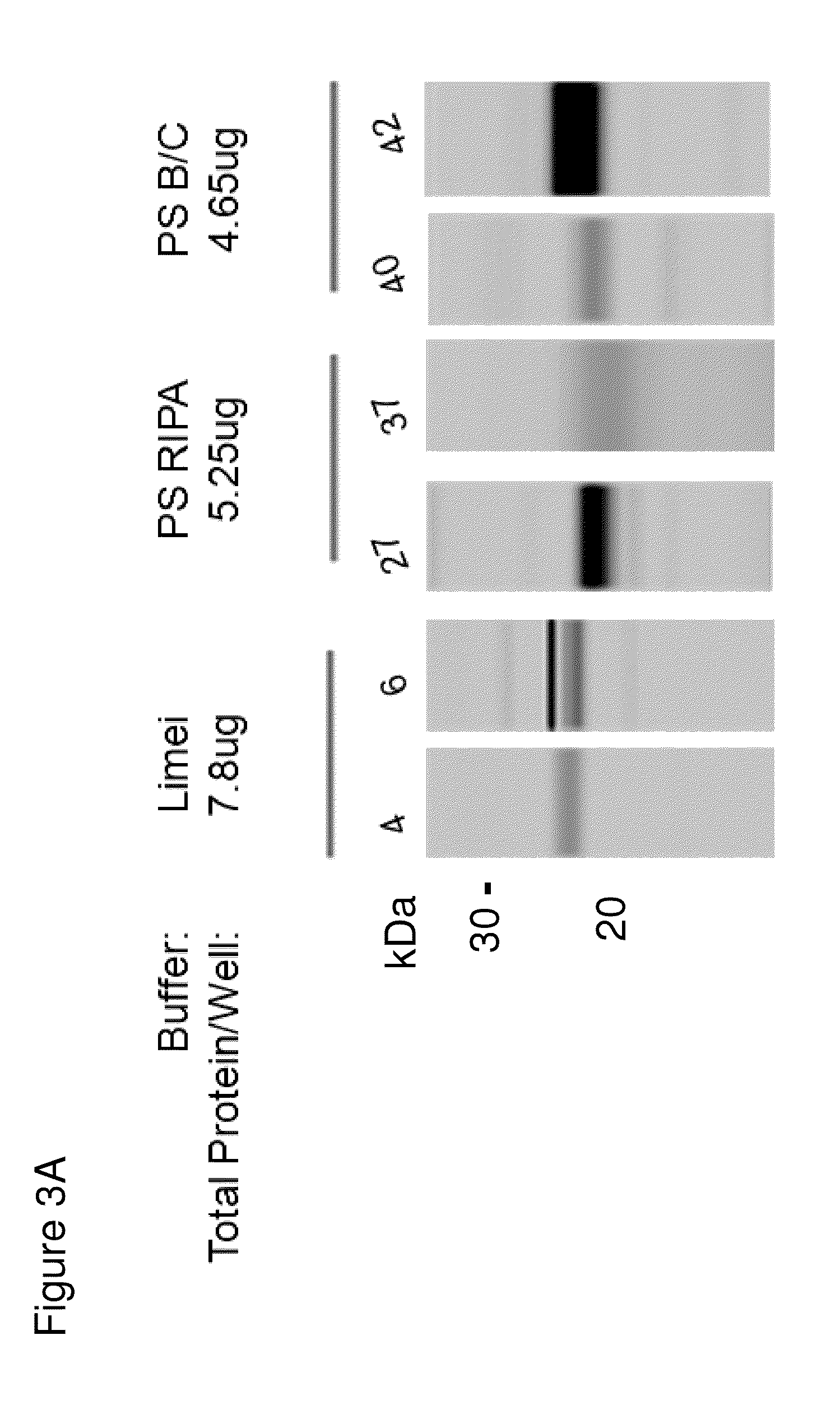 Methods and kits for diagnosing sjogren's syndrome