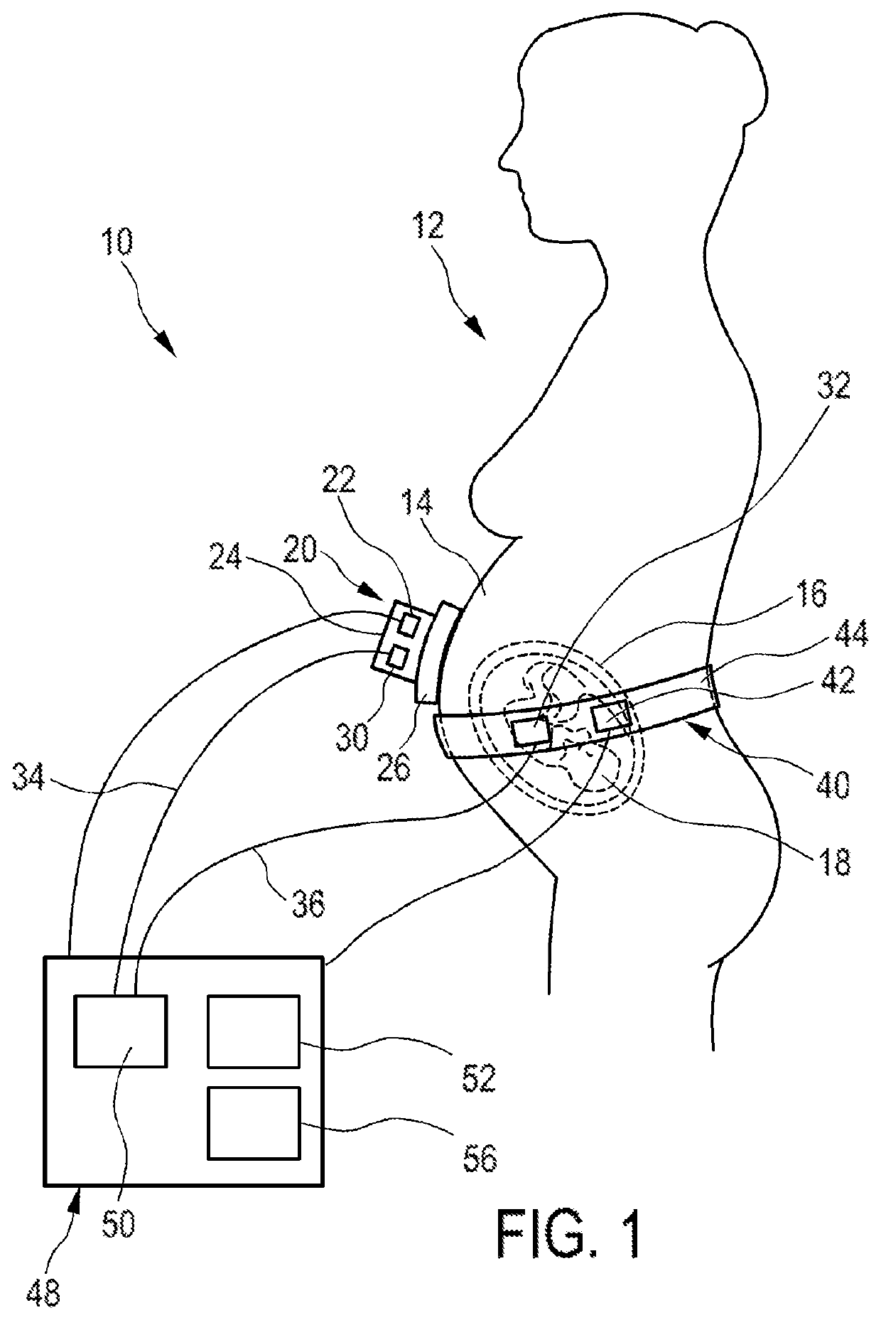 Pregnancy monitoring system and method