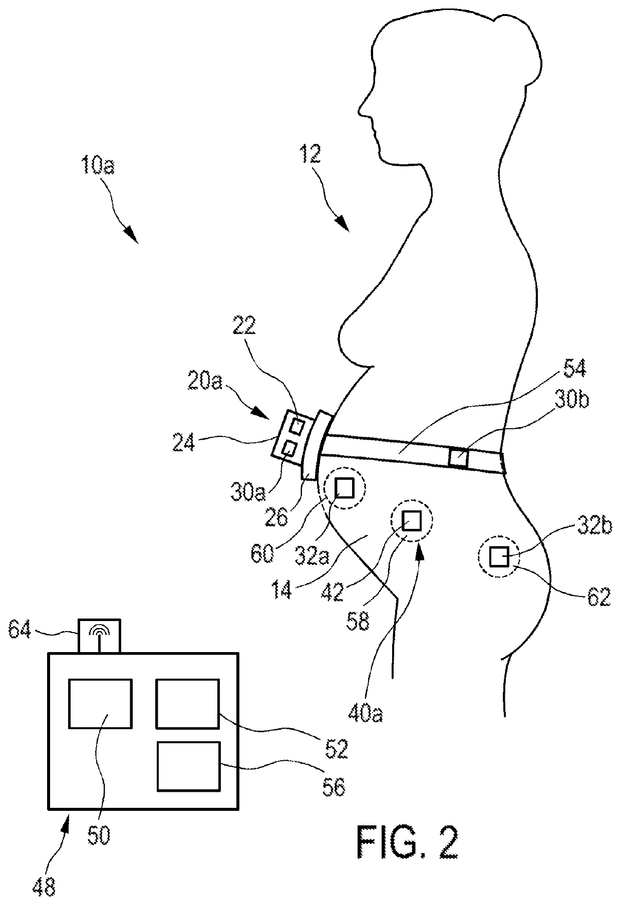 Pregnancy monitoring system and method