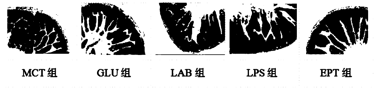 Application of lactic acid bacteria combined with medium-chain triglyceride in repairing intestinal inflammation