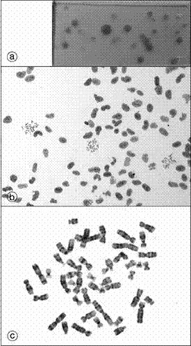 A method for in situ culture of amniocytes and karyotype processing and analysis on glass slides