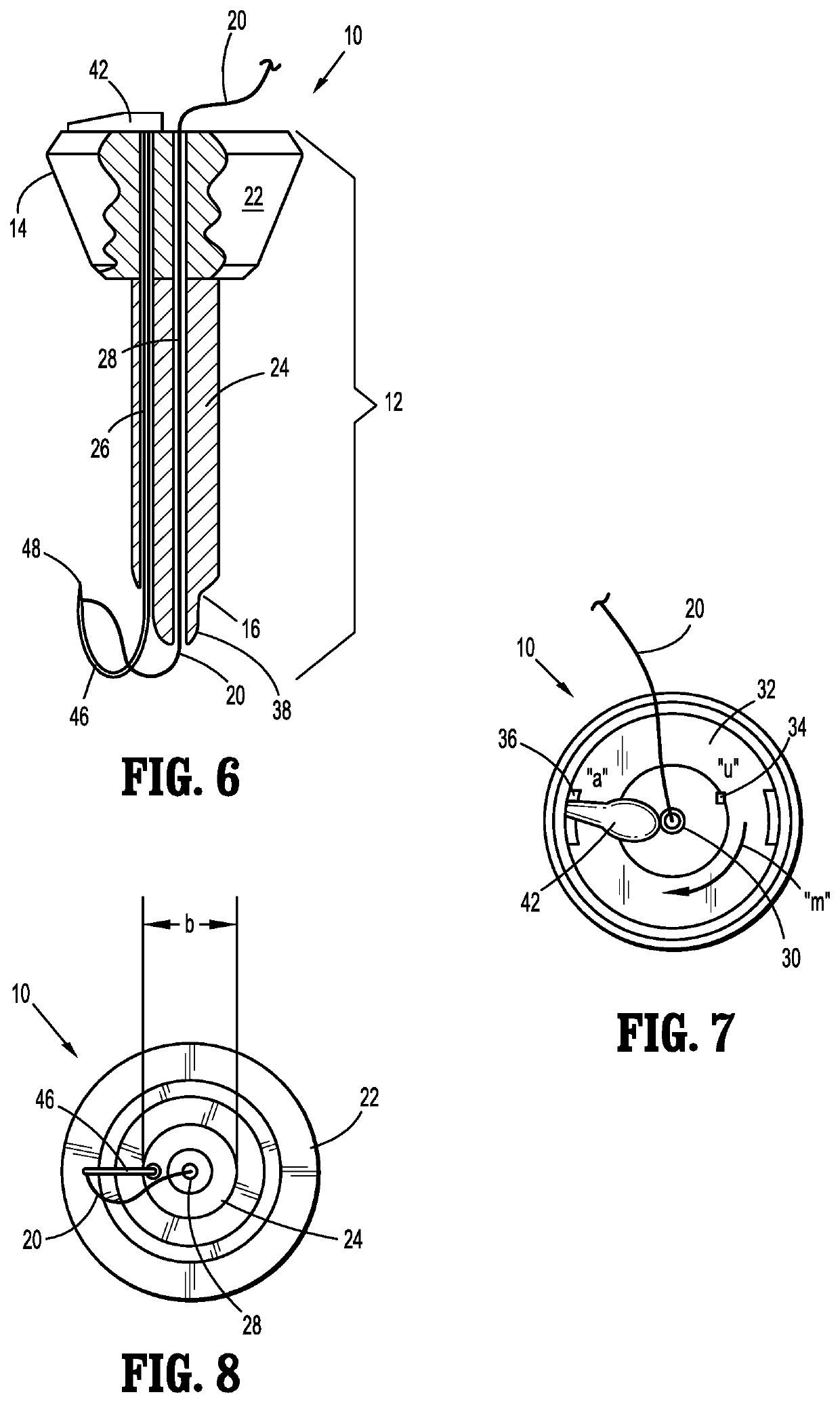 Surgical wound closure apparatus