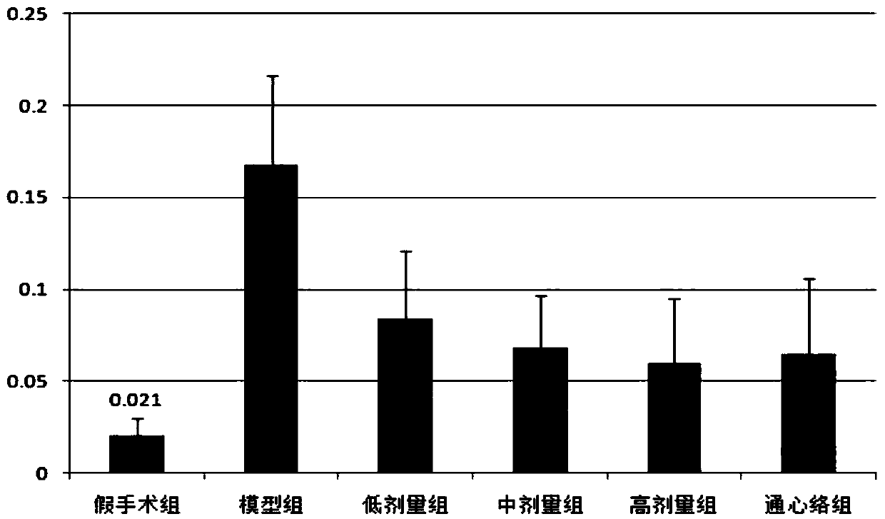 Traditional Chinese medicine composition for treating acute coronary syndrome and preparation method thereof