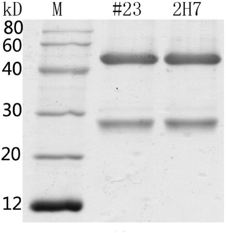 Monoclonal antibody resistant to SasA (staphylococcus aureus surface protein A) antigen and application of monoclonal antibody