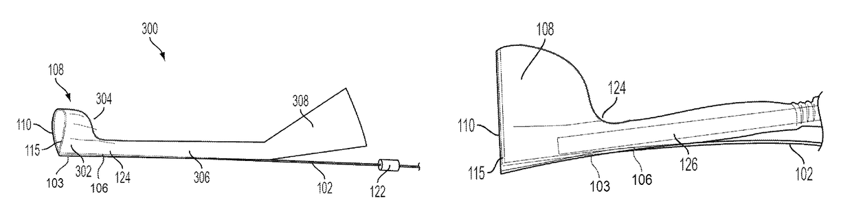 Devices and methods for removal of calculus