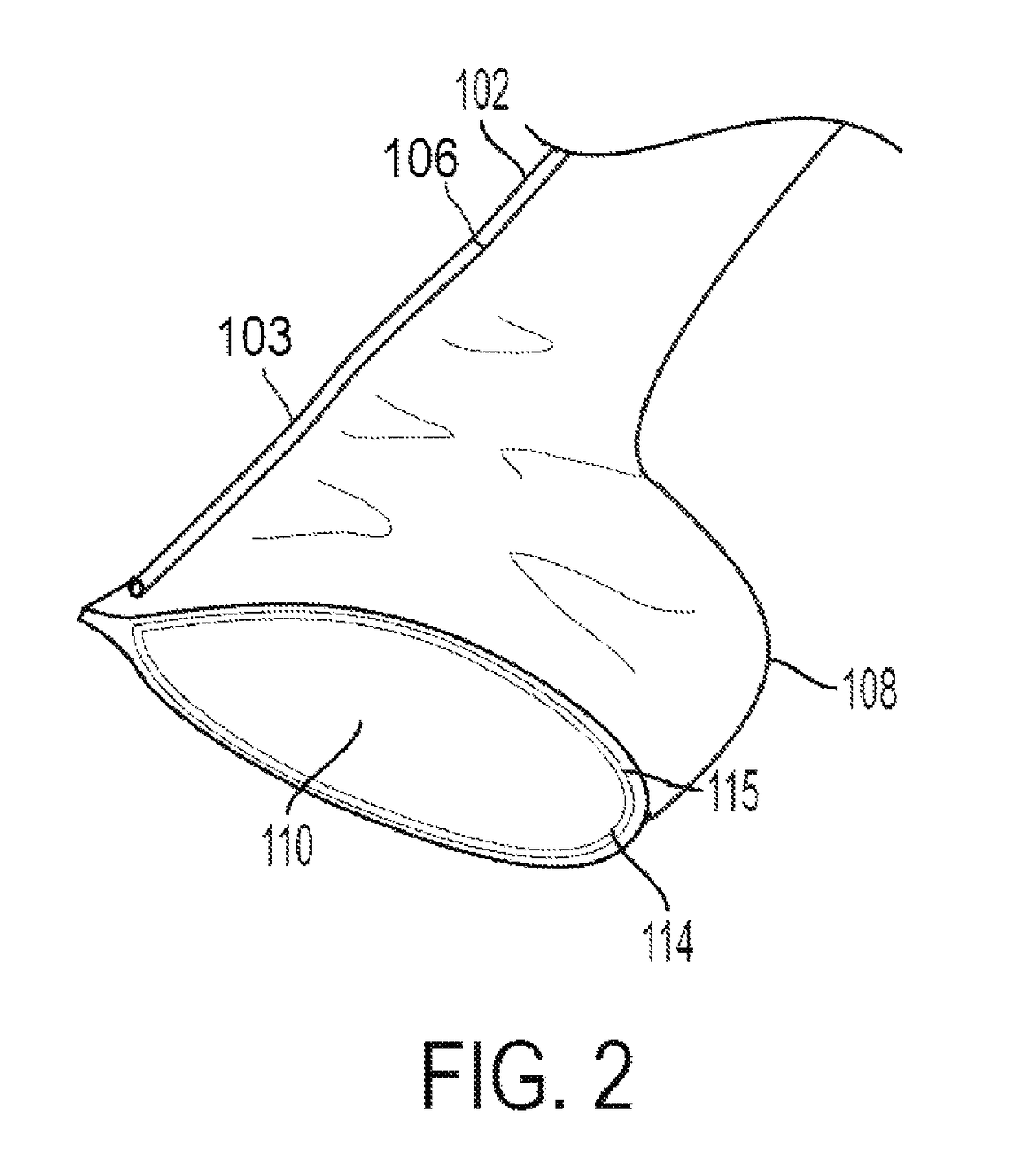 Devices and methods for removal of calculus