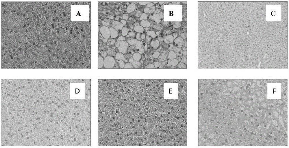 Application of hydroquinone farnesyl group compound