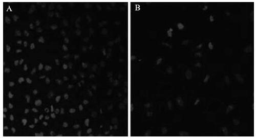 An injectable temperature-sensitive hydrogel intraocular lens material with cell membrane bionics and its preparation method