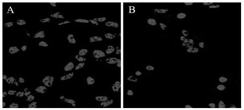 An injectable temperature-sensitive hydrogel intraocular lens material with cell membrane bionics and its preparation method