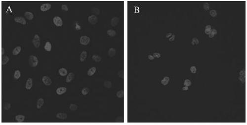 An injectable temperature-sensitive hydrogel intraocular lens material with cell membrane bionics and its preparation method