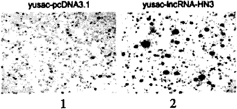 Long non-coding RNA sequence relevant to human melanoma cells and application thereof