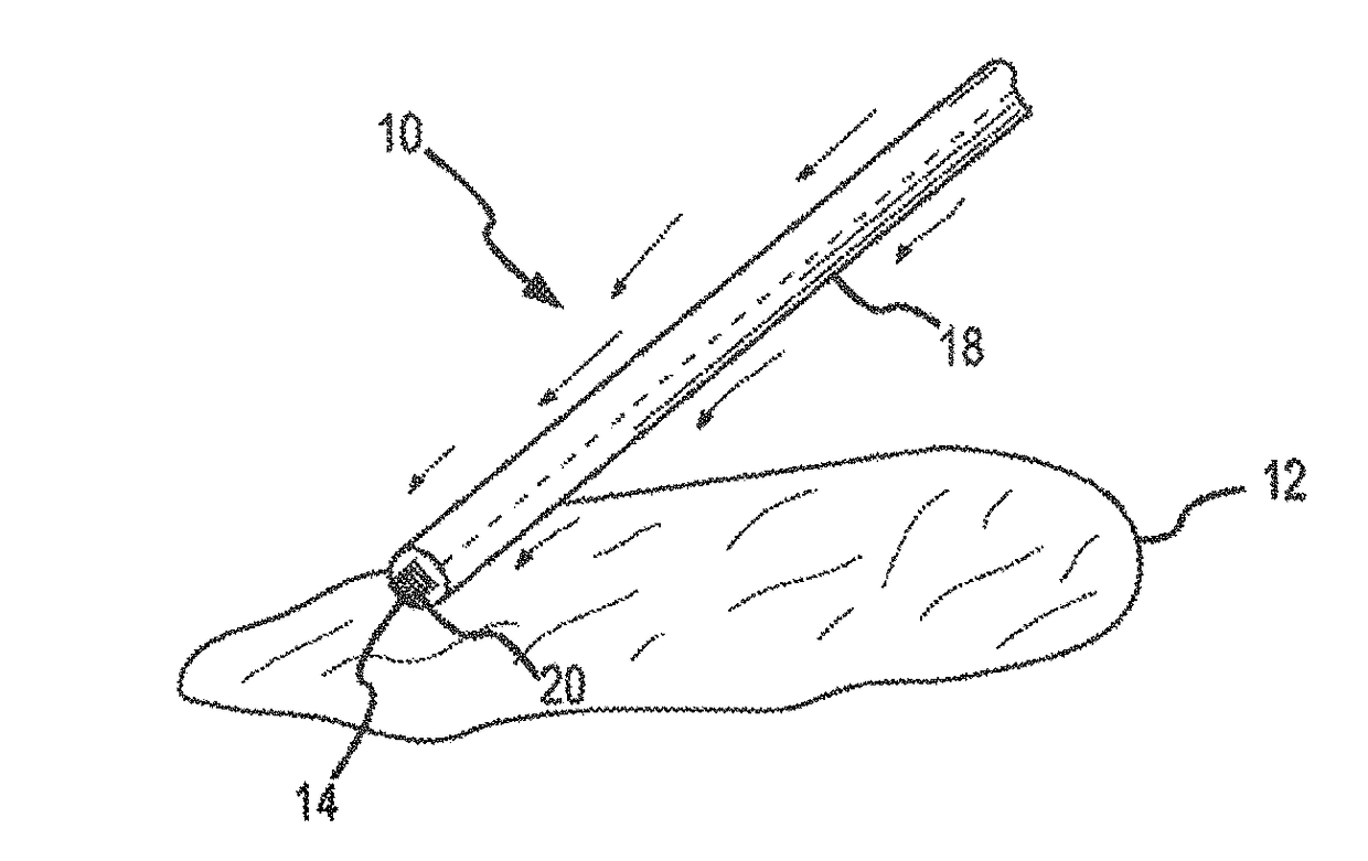 Acoustic coupling for assessment and ablation procedures