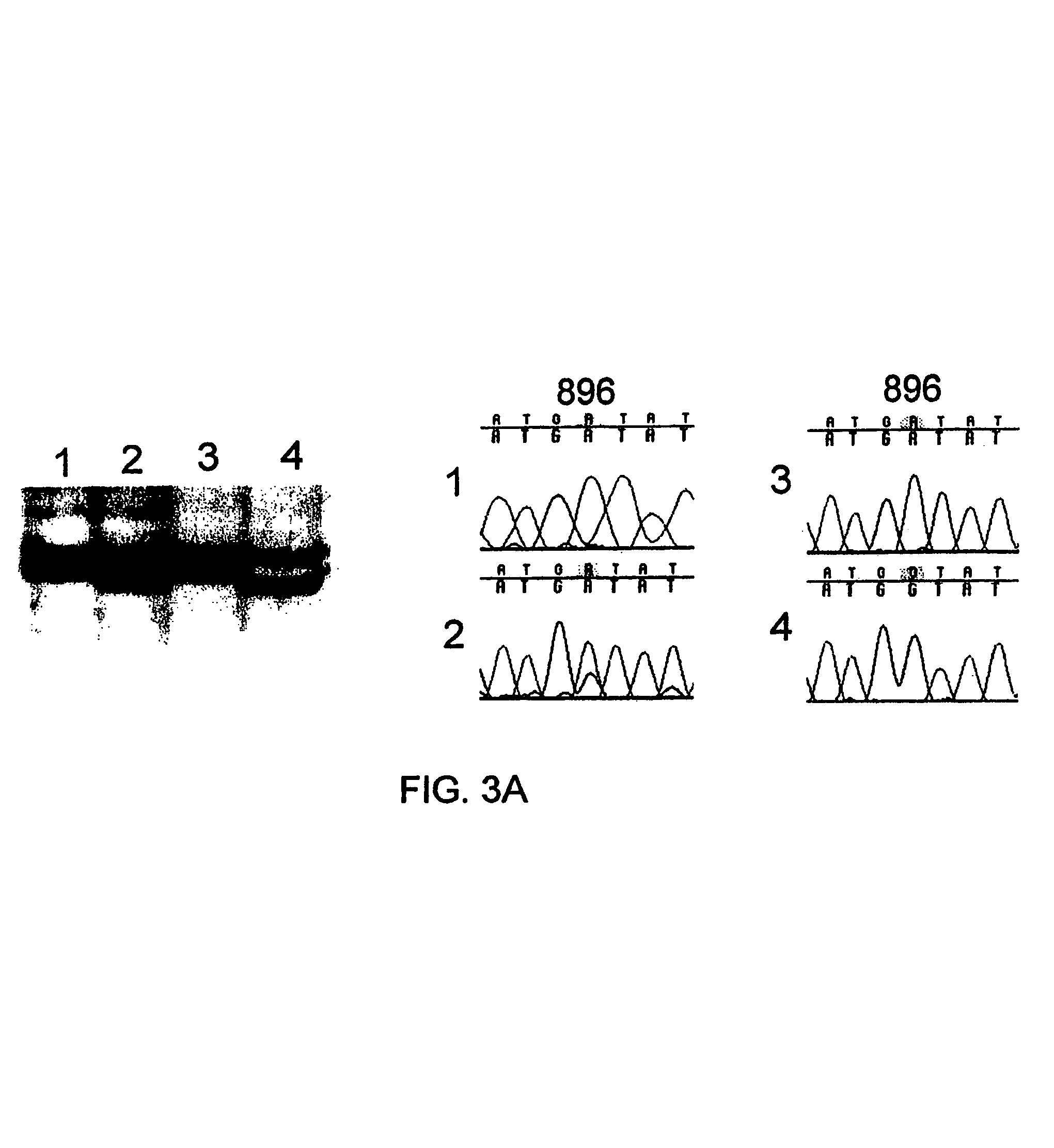 Variant TLR4 nucleic acid and uses thereof