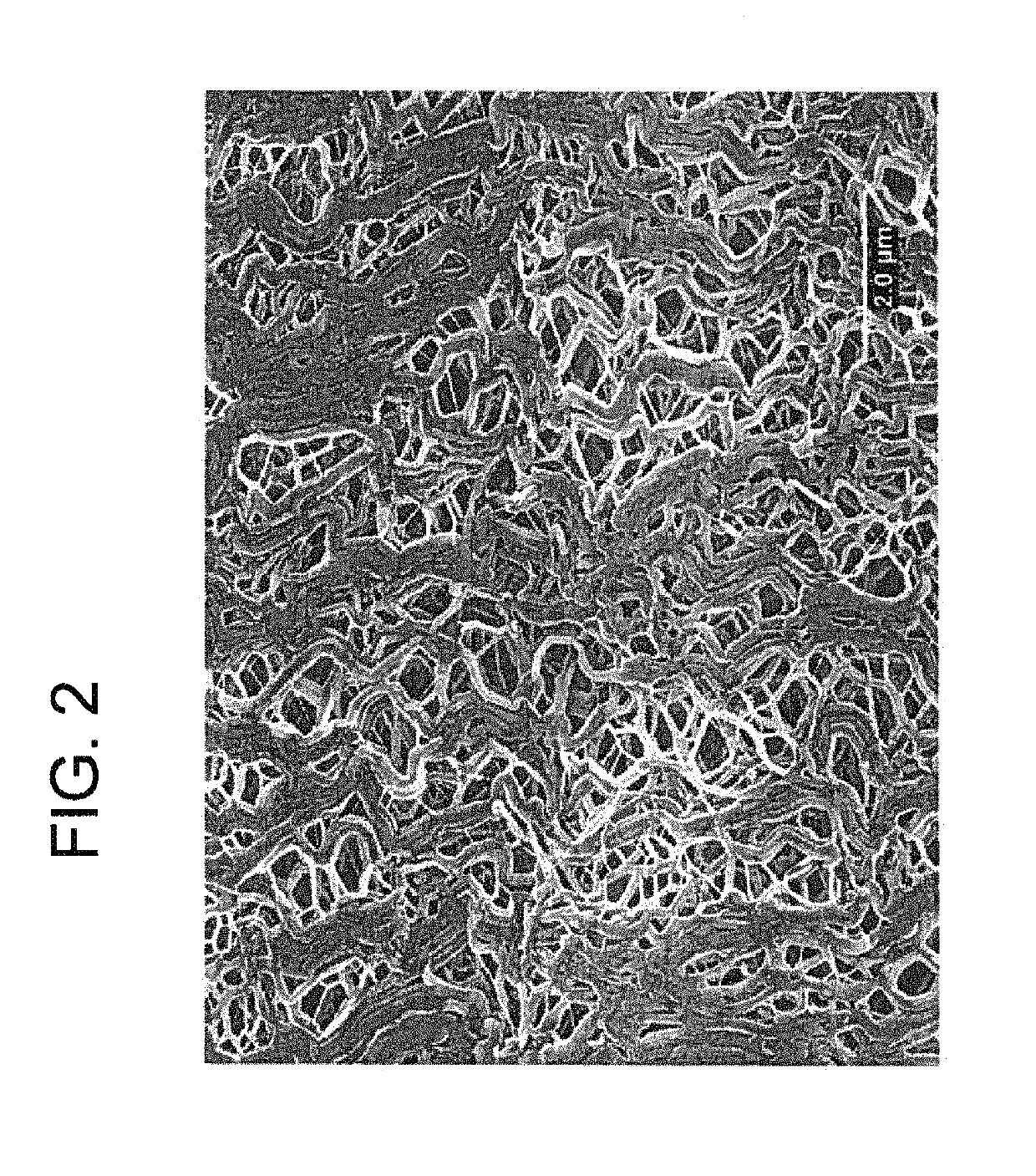 Medical balloon devices and methods