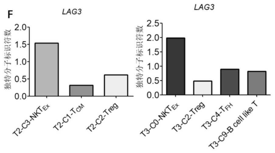 Bladder cancer depleted NKT cell subset, characteristic gene and application thereof