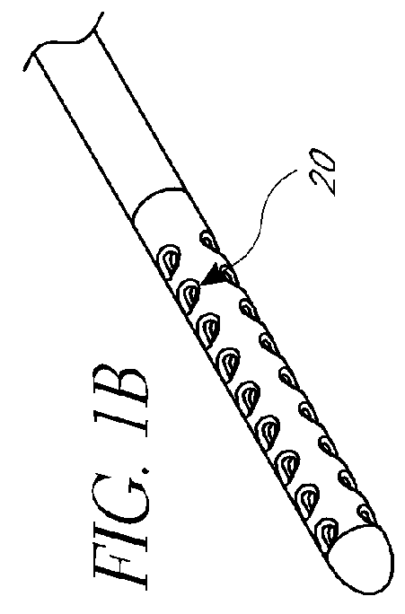 Method and apparatus for treatment of intracranial hemorrhages