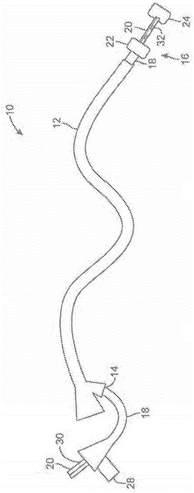 Cyrogenic treatment systems