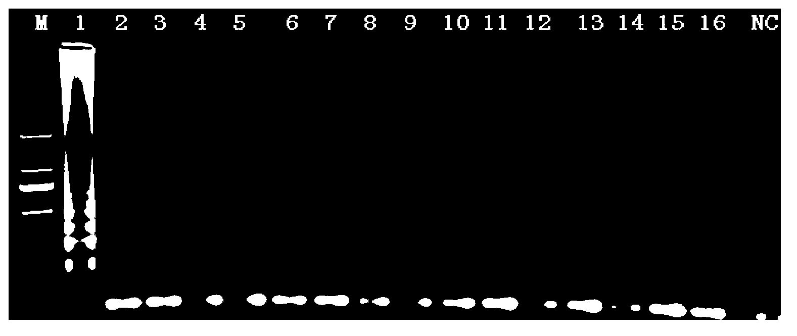 LAMP (loop-mediated isothermal amplification) detection kit of vibrio cholerae and detection method thereof