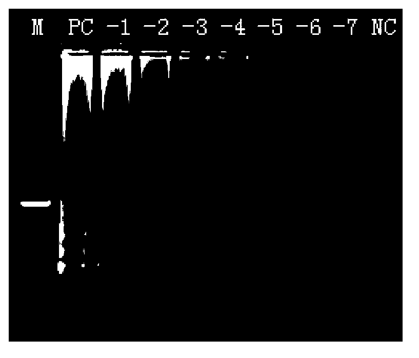 LAMP (loop-mediated isothermal amplification) detection kit of vibrio cholerae and detection method thereof