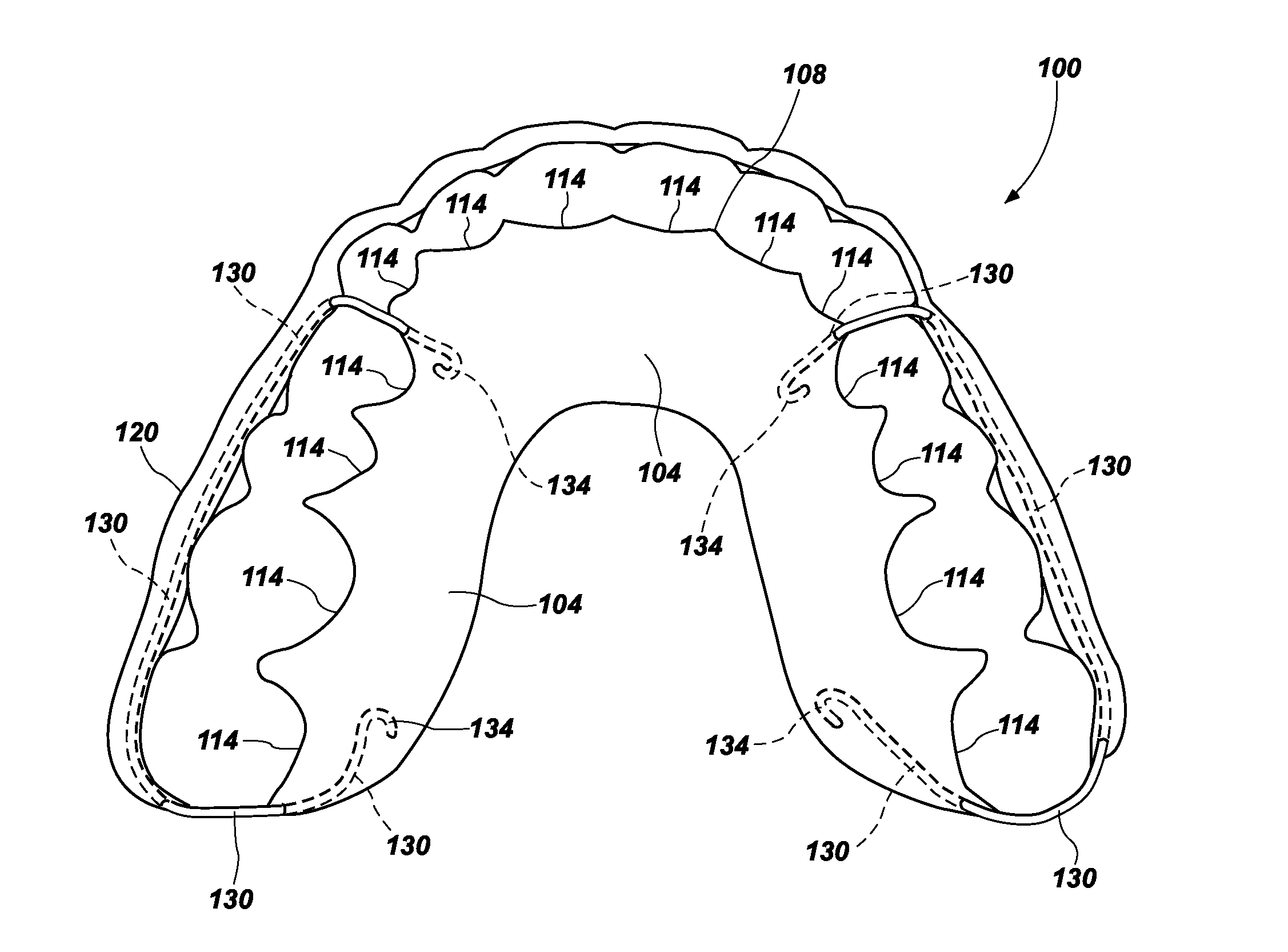 Dental Retainer