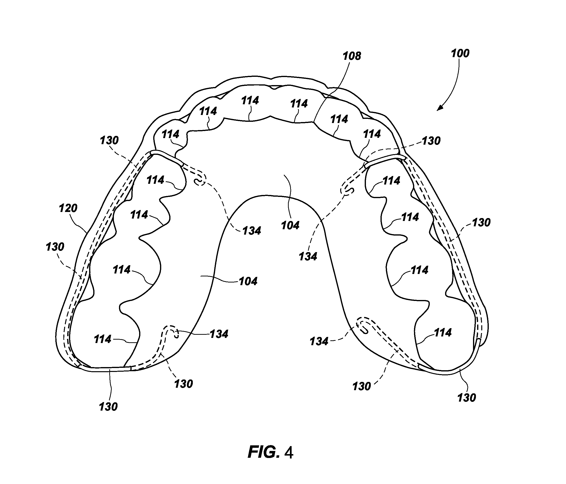 Dental Retainer