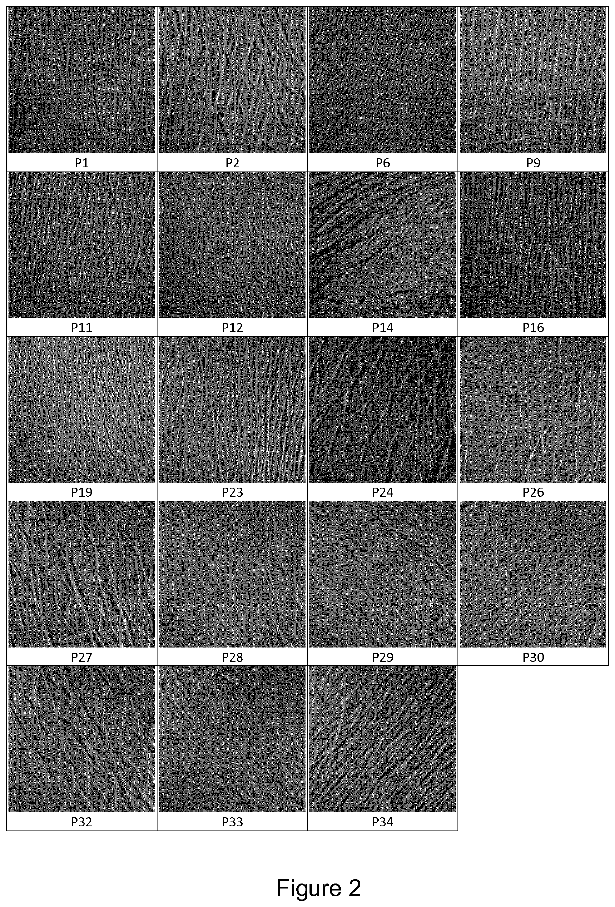 Non invasive process for the evaluation of the quality of internal dense connective tissues