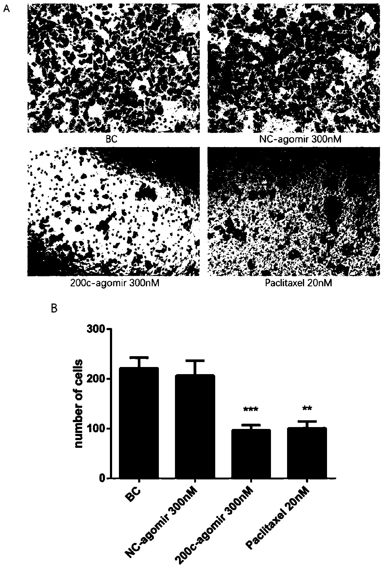 Novel preparation for treating triple-negative breast cancer